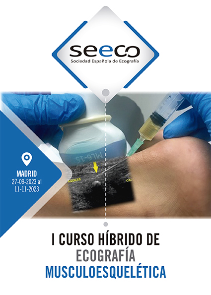 I Curso Hbrido de Ecografa Musculoesqueltica